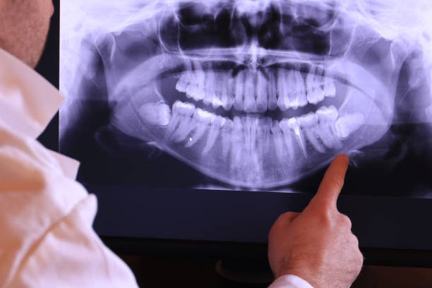 Best Cracked Tooth Emergency Dentist  in Lake Lure, NC