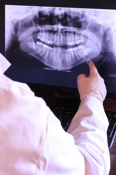 Best Knocked-Out Tooth Emergency  in Lake Lure, NC